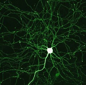 Neuronen: Künstliche Variante ist robuster (Foto: flickr.com/Mike Seyfang)
