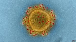 MERS-Virus: Neuer Impfstoff schützt Kamele wirkungsvoll (Foto: niaid.nih.gov) MERS-Virus: Neuer Impfstoff schützt Kamele wirkungsvoll (Foto: niaid.nih.gov)