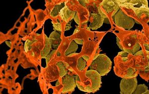 Staub: Auffangbecken für Keime und Bakterien (Foto: flickr.com/NIAID)