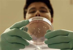 Petrischale: Gehirnteile werden nachgezüchtet (Foto: AP/Jeff Chiu) Petrischale: Gehirnteile werden nachgezüchtet (Foto: AP/Jeff Chiu)