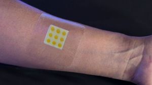 Innovativer Wundverband: Farbe zeigt Infektion an (Foto: bath.ac.uk)