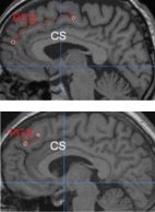 Schizophrenie: Gehirnstruktur nicht nur Chemie (Foto: cam.ac.uk, Jane Garrison)
