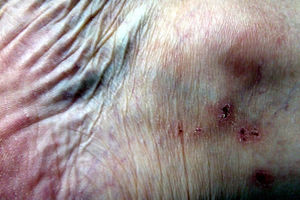 Hautproblem: Das könnte am Stress liegen (Foto: Erich Ferdinand, flickr.com)