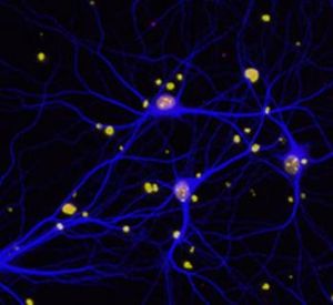 BRCA1: womöglich auch bei Alzheimer wichtig (Foto: Lennart Mucke/UCSF)