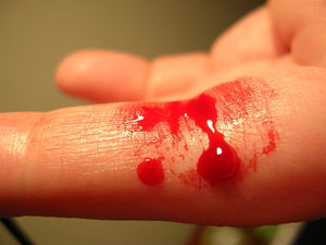 Flutender Finger: Ein Tropfen genügt für Krebsdiagnose (Foto: wikimedia.org)