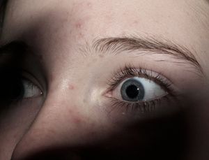 Vor Angst geweitete Augen: App warnt vor Triggern (Foto: pixelio.de/C. Falk)