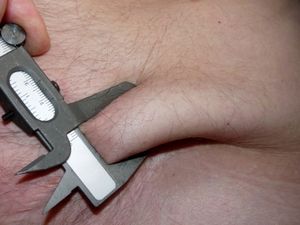 Bauchspeck: BMI ist keine ausreichende Größe (Foto: pixelio.de/Dieter Schütz)