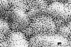 Gold-Nanoschwamm: Kontakt zwischen Pixeln und Chip (Foto: izm.fraunhofer.de)