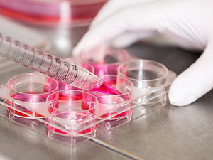 Proben im Labor: Neuer Ansatz ist wirksam, aber teuer (Foto: ucl.ac.uk)