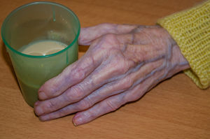 Alte Hand: Rosazea erhöht Demenzrisiko (Foto: pixelio.de, Karin Bangwa)