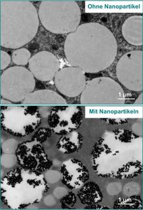 Mikroskopische Aufnahme einer menschlichen Fettzelle (Foto: ibmt.fraunhofer.de)