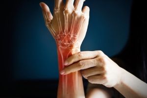 Operation bei Arthrose: Nur in schweren Fällen (© ipopba - Fotolia.com)