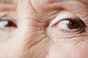 Trübung der Linse kann Vergangenheit sein (© pressmaster - Fotolia)