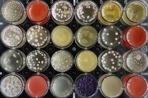 Gezüchtete Pilze im Labor (Foto: BiMM Research/Bioactive Microbial Metabolites)