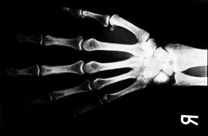 Röntgenbild: Radiologen nicht gefährdet (Foto: pixelio.de, sabine koriath)