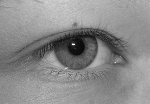 Muttermal: Bessere Chancen bei Krebs (Foto: pixelio.de, Giulia Maria Weide)