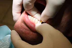 Zahnbehandlung: Medikamente sind oft unnötig (Foto: pixelio.de/Wolfgang Resmer)