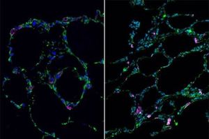 Lunge im direkten Vergleich: Labor (links) und Organ (rechts) (Foto: ucla.edu) Lunge im direkten Vergleich: Labor (links) und Organ (rechts) (Foto: ucla.edu)