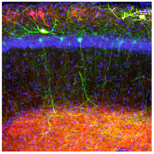 Neuronales Netzwerk des Hippocampus (Foto: dzne.de, Julia Steffen)