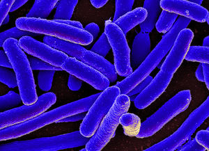 E. coli: Nicht alle Stämme machen krank (Foto: PRONIAID, flickr.com)