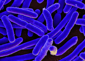 E. coli: Nicht alle Stämme machen krank (Foto: PRONIAID, flickr.com) E. coli: Nicht alle Stämme machen krank (Foto: PRONIAID, flickr.com)