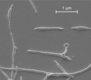 Mycoplasma pneumoniae: löst das GBS aus (Foto: Front Microbiol.2016;7:329)