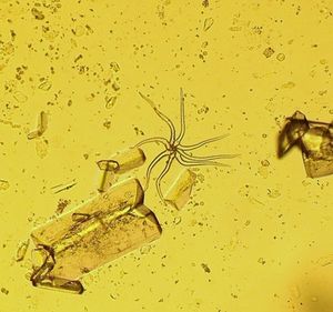 Bestandteile im Urin: neuer Test für CJK (Foto: pixelio.de, Stefanie Leistner)