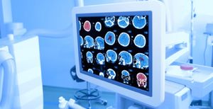 Mit neuester Technik: Neurochirurgie in Siegen (© sudok1 - Fotolia)