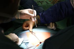 Operative Entnahme der Nebenschilddrüsen beim Spender (Foto: UKR)