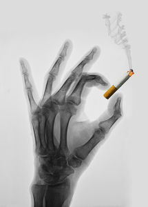 Hand mit Zigarette: Krebssymptome ernst nehmen (Foto: pixelio.de/Bernd Kasper)