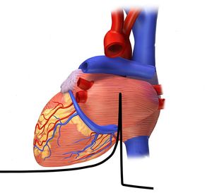 Herzrhythmus mit Ionen (Bild: Blausen.com staff. CC BY 3.0, remix by GSI)