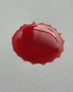 Tropfen Blut: Behandlungsort entscheidet (Foto: pixelio.de, Merle Stechow) Tropfen Blut: Behandlungsort entscheidet (Foto: pixelio.de, Merle Stechow)