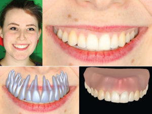 Zahnfleisch und Gebiss (Foto-Set: Computer Graphics Lab, disneyresearch.com)