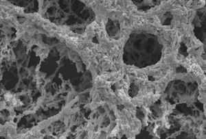 Pneumokokken mit Ruß: Das ist eine ungesunde Mischung (Foto: le.ac.uk )