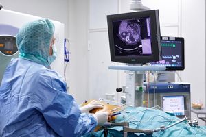 Irreversible Elektroporation: neue Hoffnung für Krebspatienten (Foto: ukr.de)