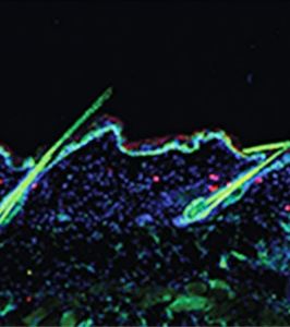 Maushaut mit Haaren und Tregs (rot) (Bild: universityofcalifornia.edu)