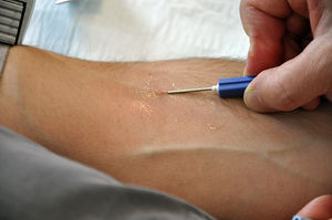 Nadel im Arm: Diskriminierung in den USA (Foto: Andreas Faessler/Wikipedia)