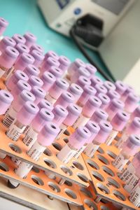 Im Labor: Hoffen auf neues Krebsmedikament (Foto: greg_chi , pixabay.com)