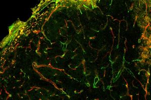 Mit dem Fluoreszenzmikroskop beobachtetes Zellwachstum (Foto: ucla.edu)