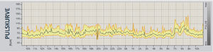 Pulskurve zeigt Stresslevel an (Copyright: EZ-Akademie)