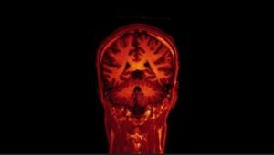 Blick ins Gehirn: KI wertet Scans aus (Foto: Flickr.com/Jon Olav Eikenes)