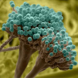 Pilzsporen: Körper leitet Selbstmord-Mechanismus ein (Foto: uni-goettingen.de) Pilzsporen: Körper leitet Selbstmord-Mechanismus ein (Foto: uni-goettingen.de)