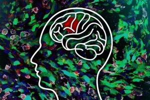 Gehirn im Fokus: Forscher finden neuen Krebs-Mechanismus (Foto: web.mit.edu)