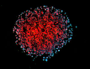 3D-Spheroid von Brustkrebszellen: neuer Signalweg entdeckt (Foto: tum.de)