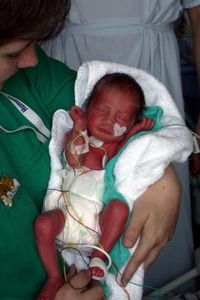 Baby nach der Geburt: verzögerte Abnabelung gut (Foto: N. Schmitz, pixelio.de)