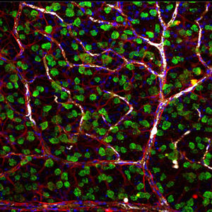 Netzhaut mit Ganglien (grün), Asterozyten (rot), Blut (weiß) (Foto: J. Sivak/UT) Netzhaut mit Ganglien (grün), Asterozyten (rot), Blut (weiß) (Foto: J. Sivak/UT)