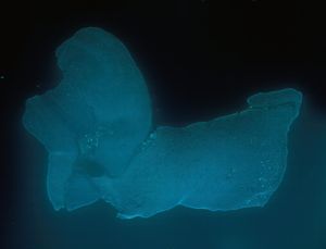 Gehirnprobe: Veränderungen bei Alzheimer nachgewiesen (Foto: alleninstitute.org)