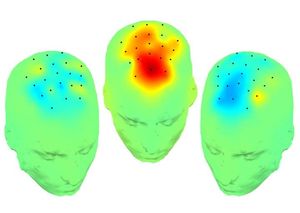 Gehirn-Screens: deutlicher Unterschied bei Stimulation (Foto: bit.ly/2jrwAKM)