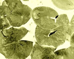 Krebszellen: Entwicklung ist vorhersagbar (Foto: pixelio.de, A.Dreher)