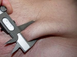 Speckrolle: Fettabbau durch neue Medikamente (Foto: Dieter Schütz, pixelio.de)